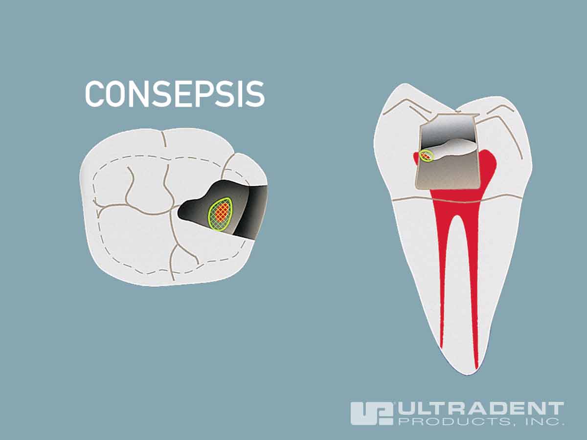 UltraBlend plus инструкция 2